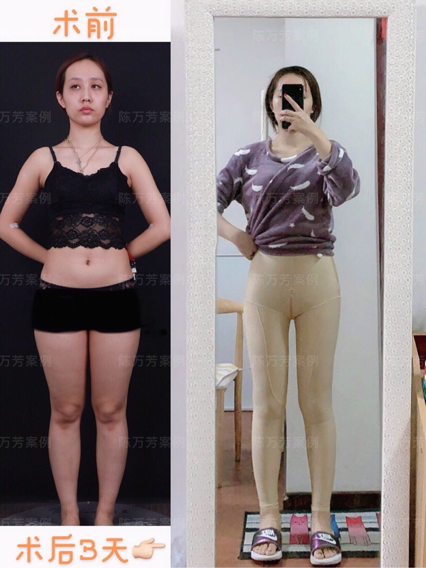 4岁女儿总说 屁屁疼 妈妈慌忙送娃去医院检查 医生 来晚了