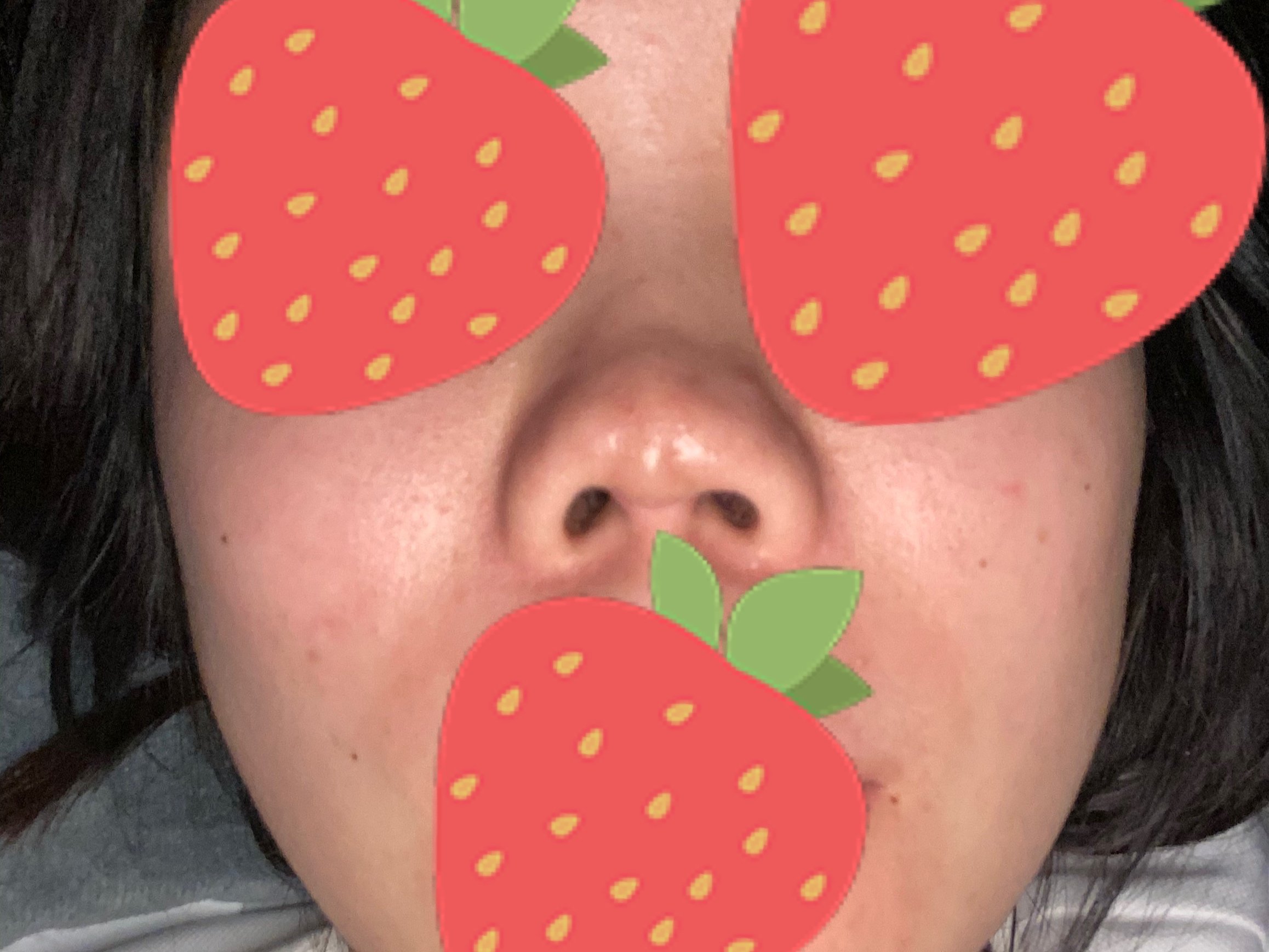 鼻假体取出后挛缩必须等六个月后才能修复吗