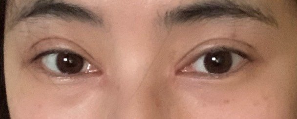 眼角开的过尖过大