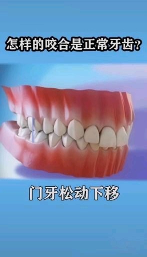 牙齿的正确咬合96简单的讲就是牙齿在上下牙弓排列整齐_圈子-新氧