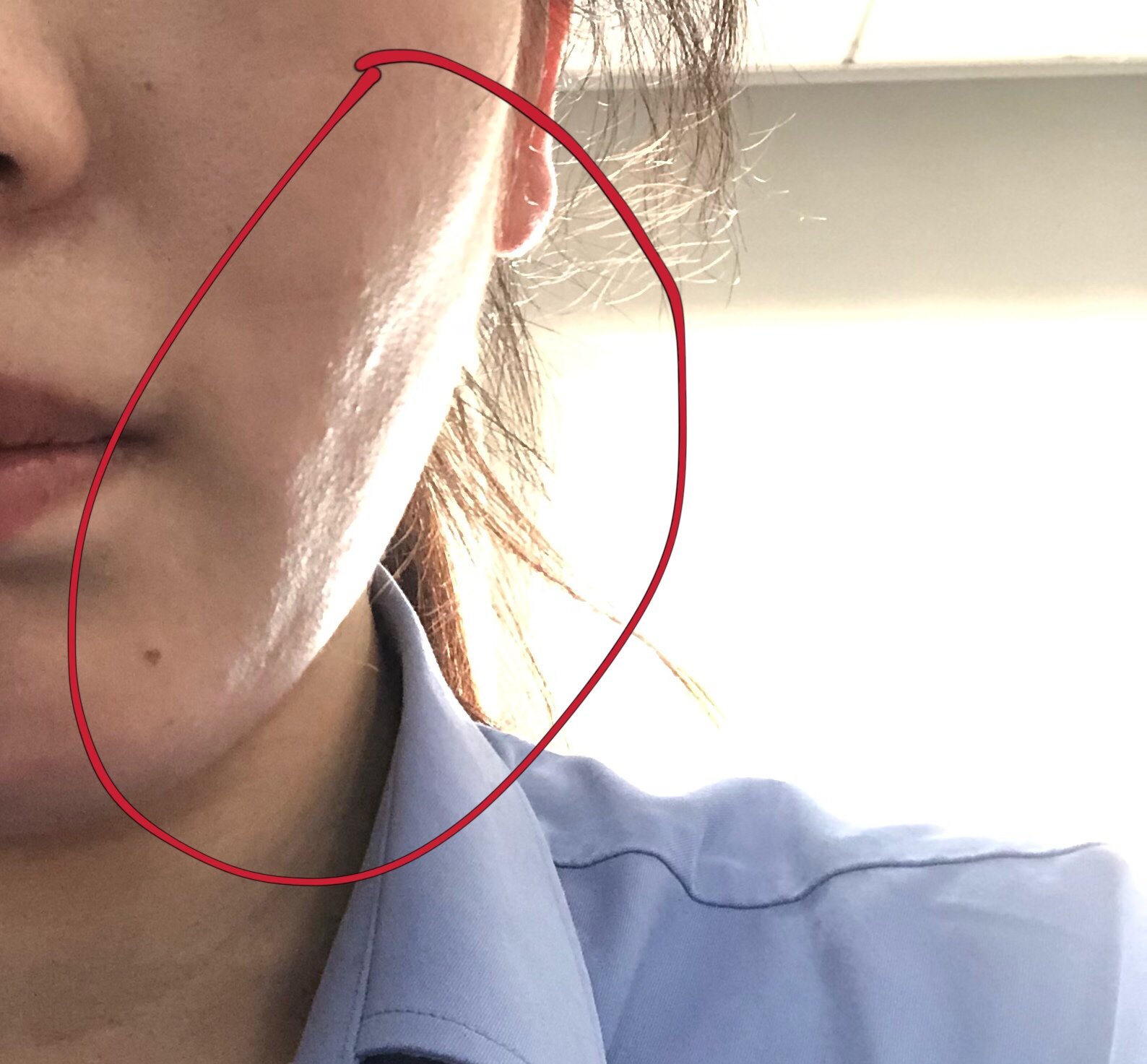 脸上有明显的沟壑把脸分得一块一块的不是皱纹怎么办