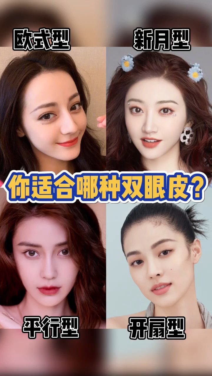测试你适合哪种类型的双眼皮71