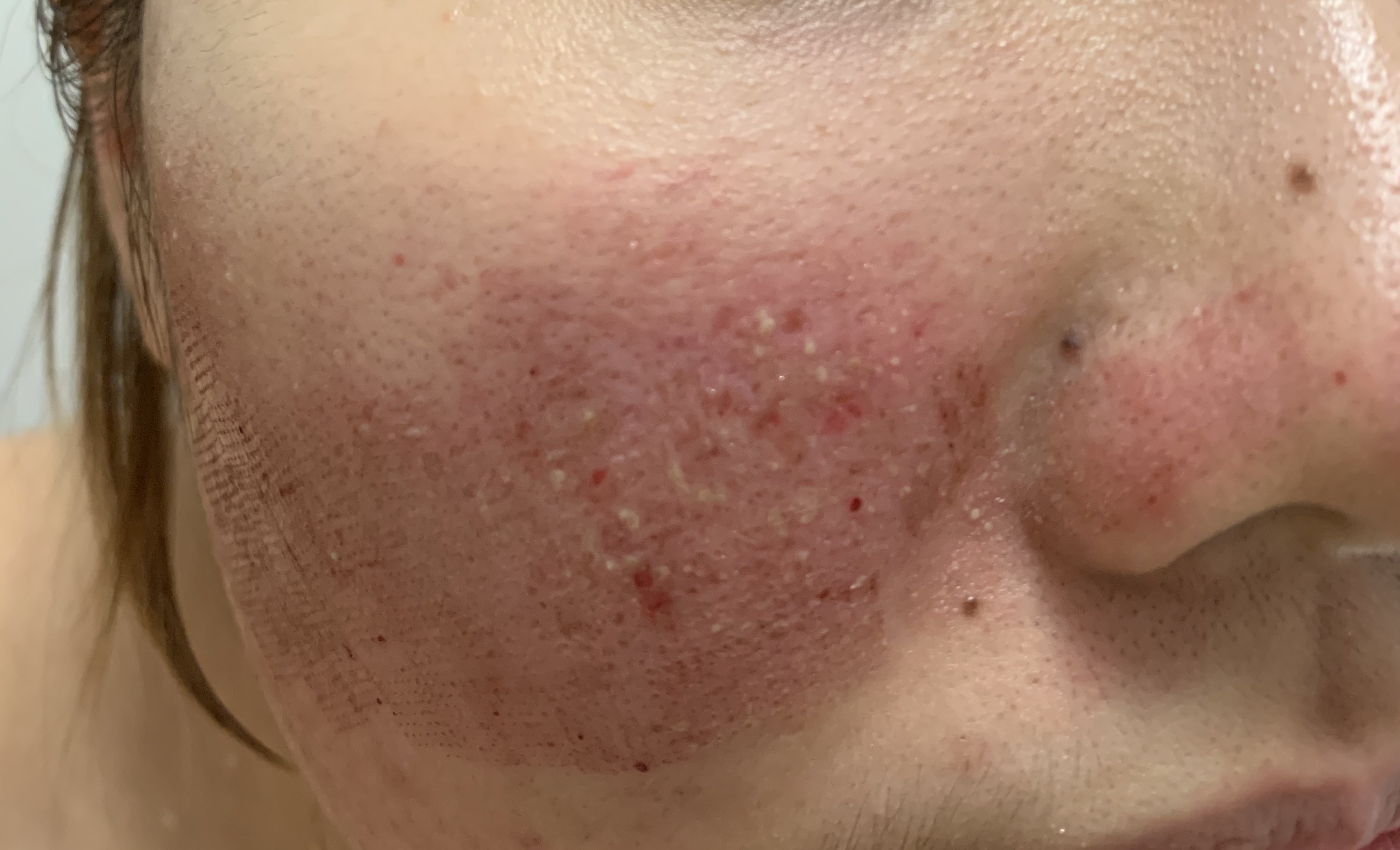 今天是做的第二天