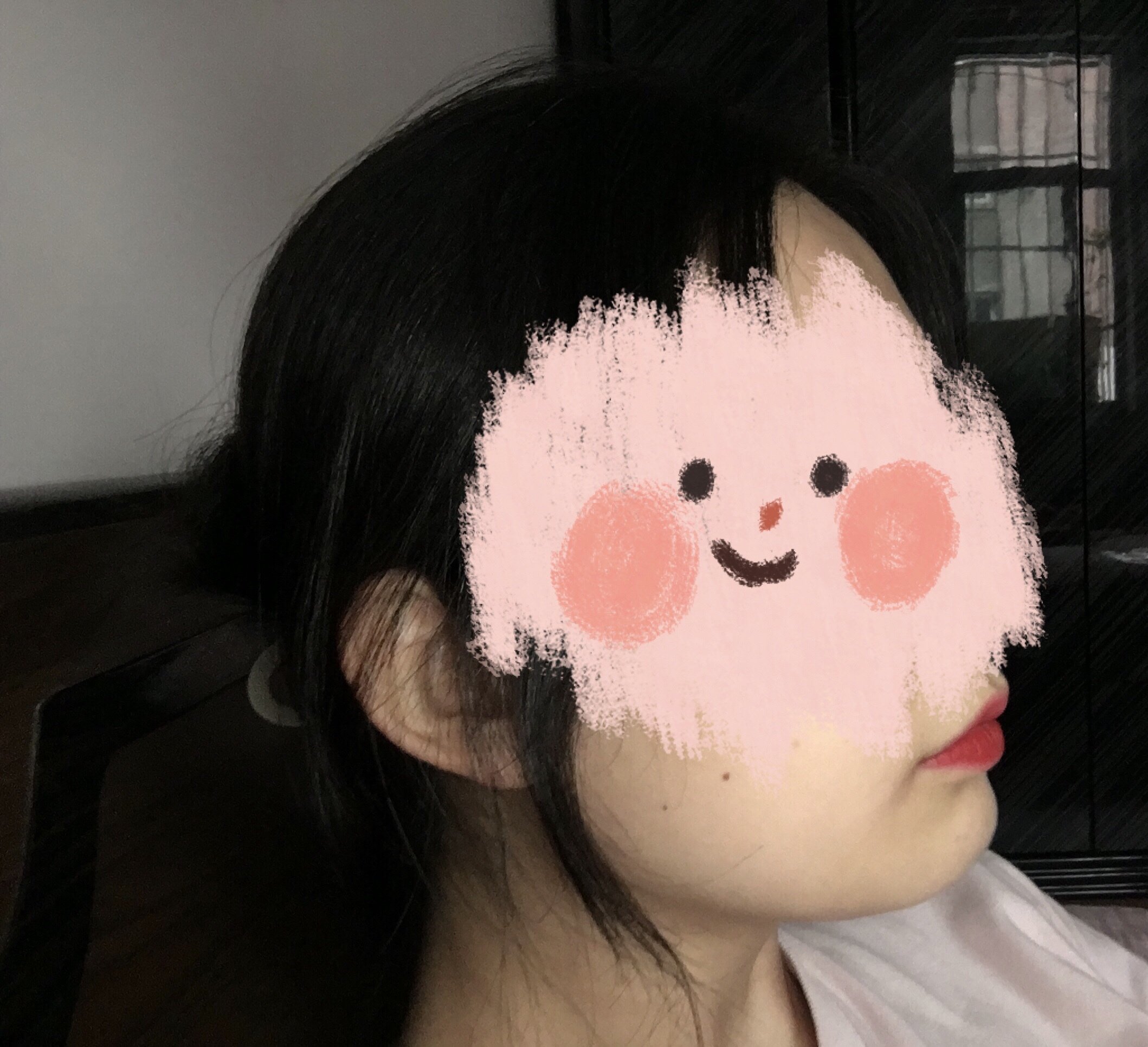 也不是胖但下巴平的和脖子连一起原来不明显后面正畸以后脸宽了就双