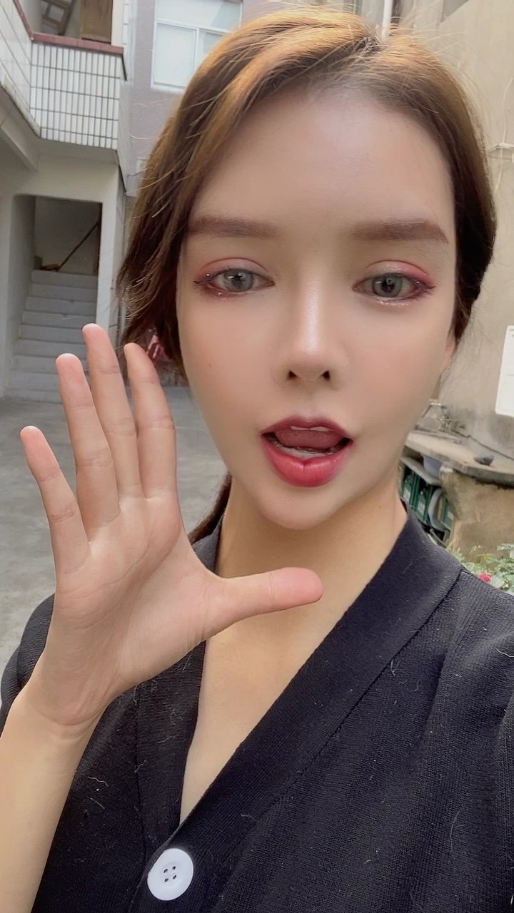 人中沟加深77人中缩短4个月