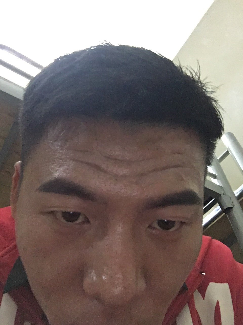 年龄岁有静态抬头纹可以去除吗