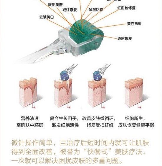 微针和黄金微针有什么区别