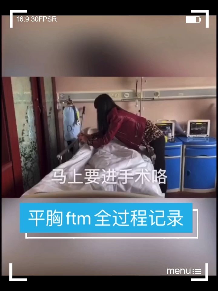 女变男手术成果图片