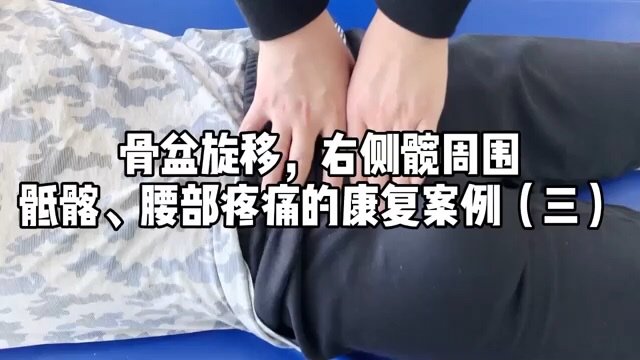 骨盆旋移右側髖周圍骶髂腰部疼痛的康復案例三