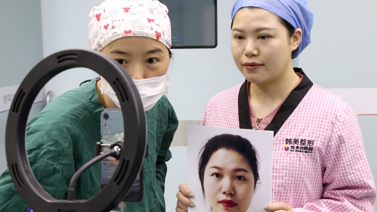 陈丹丹医生眼睛手术做的很好哦,刚做完看着都变了一个_圈子-新氧美容