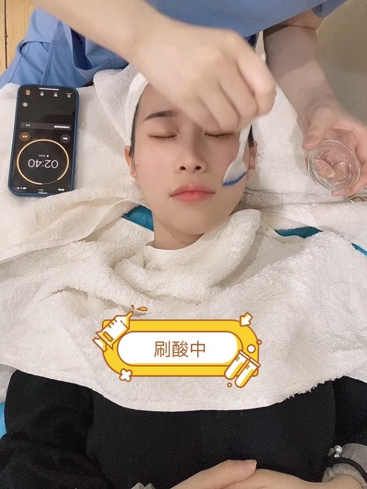 刷酸第一次刷酸