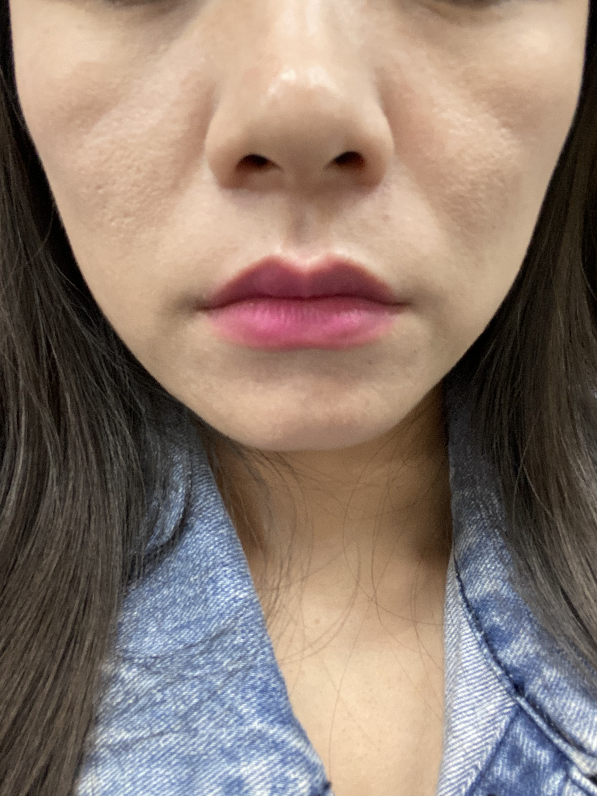 这几条凹痕可以通过填充去掉吗