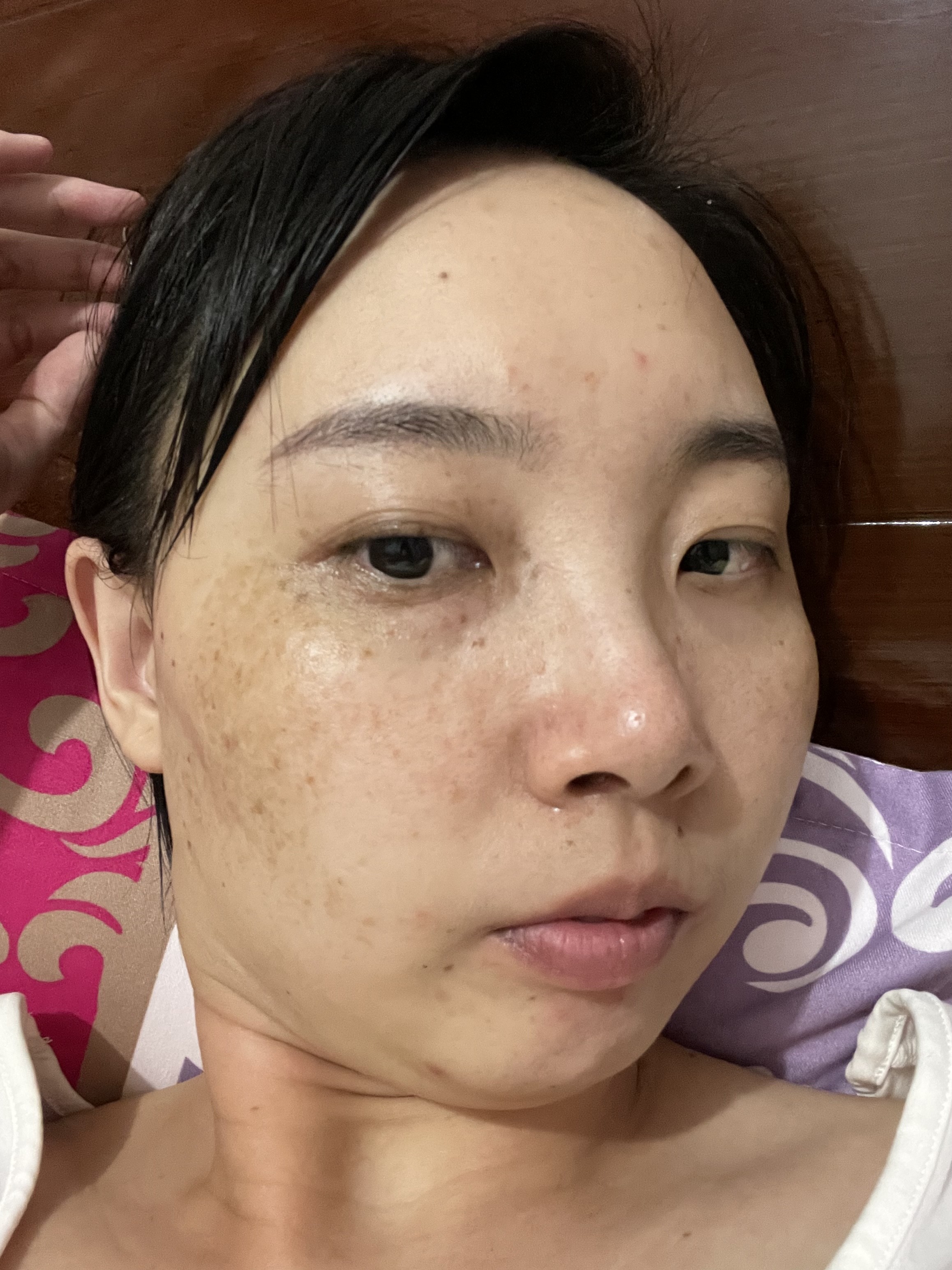 斑点更严重了我去….这也太可怕了吧