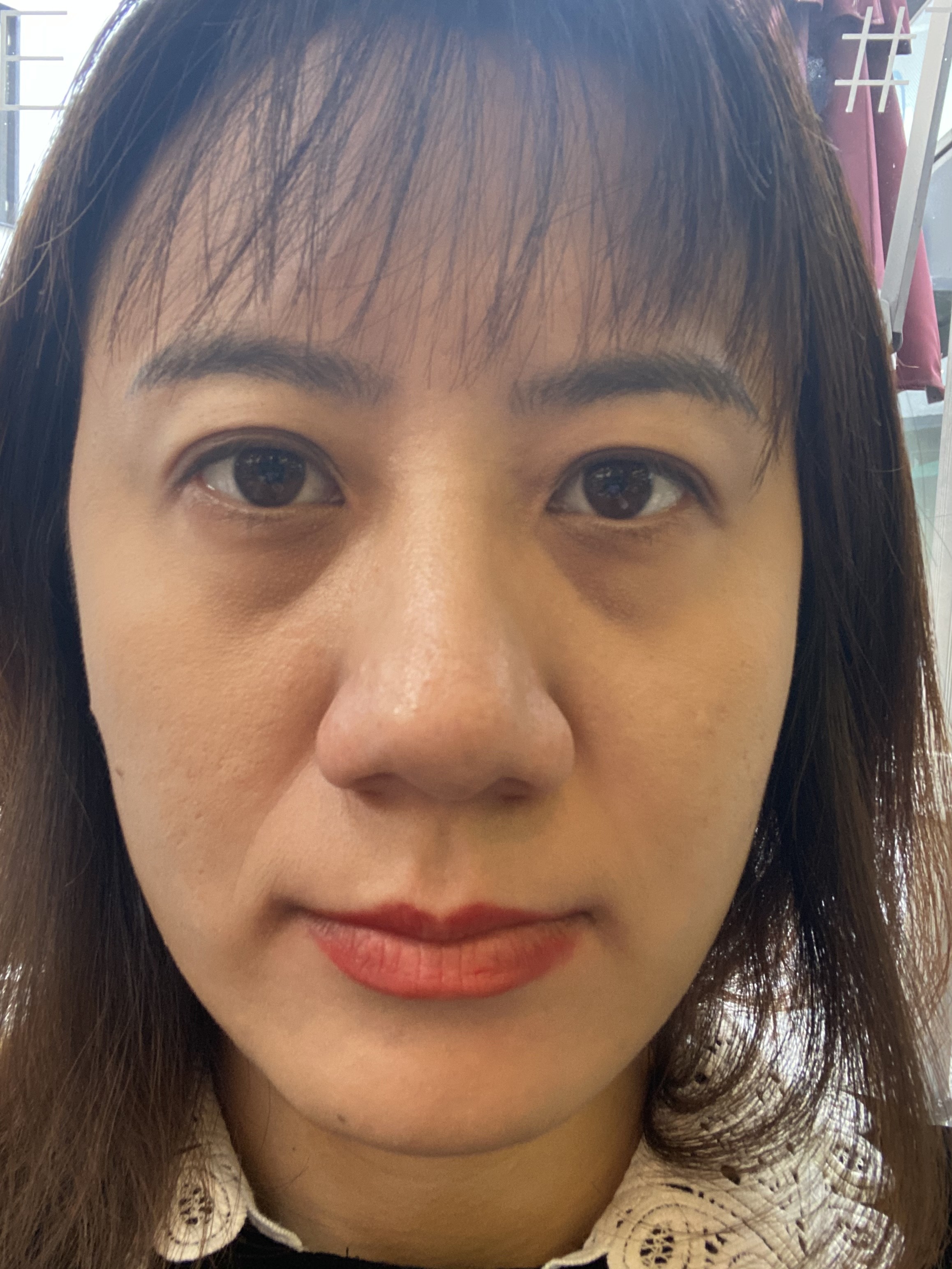 一个月了仍然感觉皮肤好干好干下垂好像没有改善