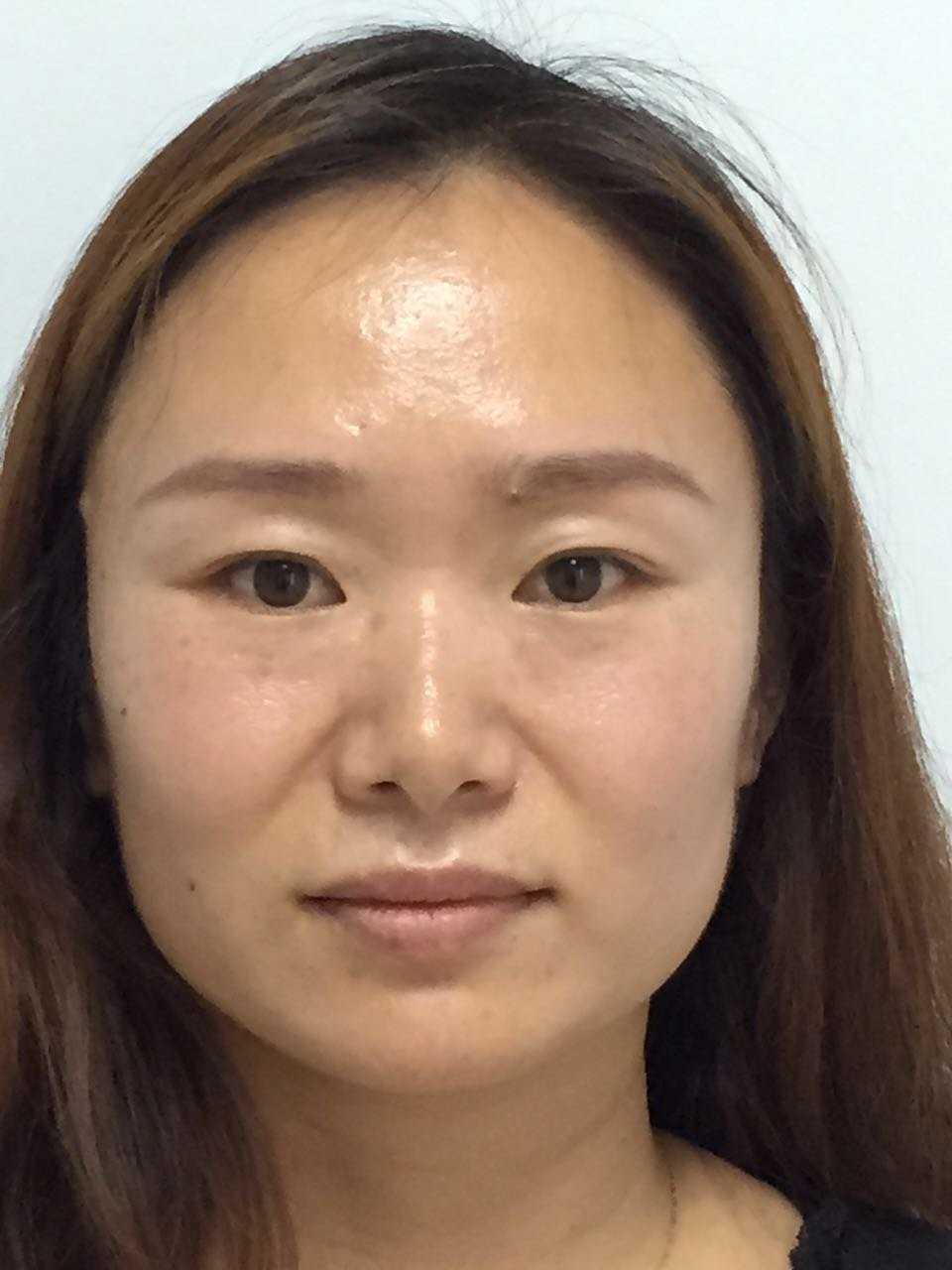 大家看看我这张油光满面,暗黄色沉的脸….这个大太阳