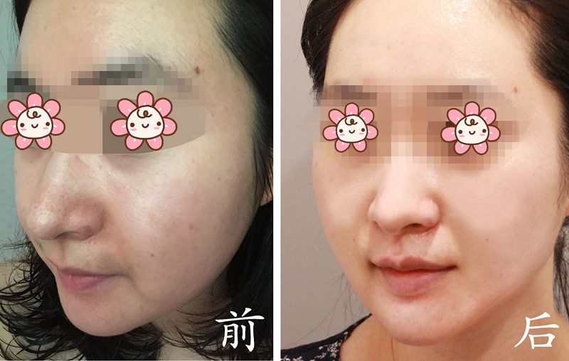 一白遮百丑嘛 皮肤好了五官不漂亮看起来都会很美呢 (*^__^*)