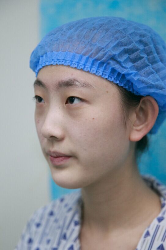 【韩氏精品重睑( 双眼皮手术 ) 开内眦(开内眼角) 轻度上睑下垂矫正】