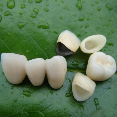 【牙齿修复】【松丰特惠】美国3m{p60}树脂补牙