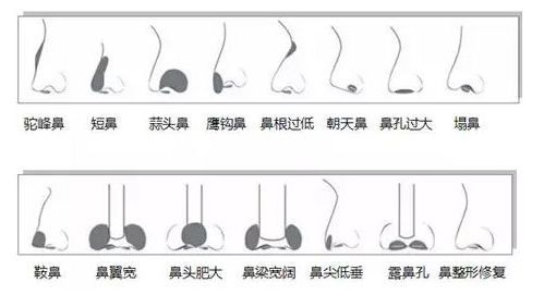 在众多鼻型中,你最不喜欢哪一种?