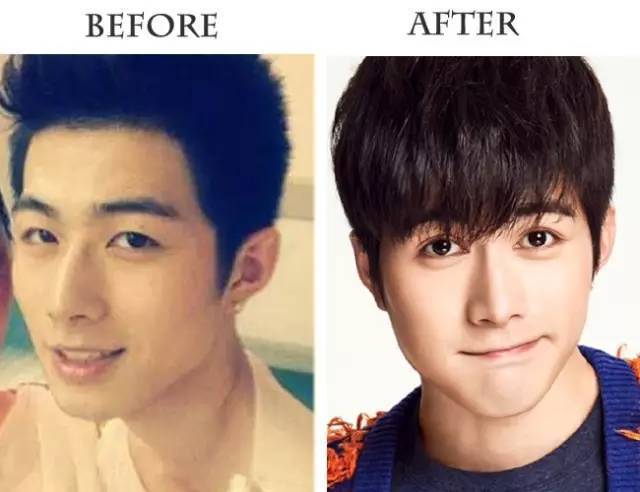 只差这一步,屌丝变男神双眼皮的帅哥很迷人有一种帅,_圈子-新氧美容