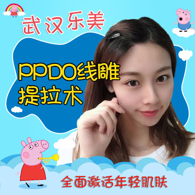 【埋线提升】【拍单即送水光针3次】韩国美迪塑逆