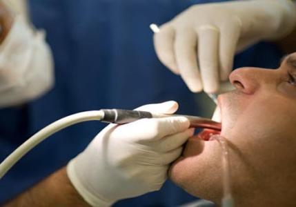 洗牙,到底洗掉了什么?可能很多人都对洗牙抱有一种疑_圈子-新氧美容整