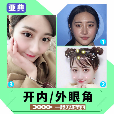 【双旦礼遇季】元旦【开内眼角】【送光电项目】诱惑妩媚の大开眼界