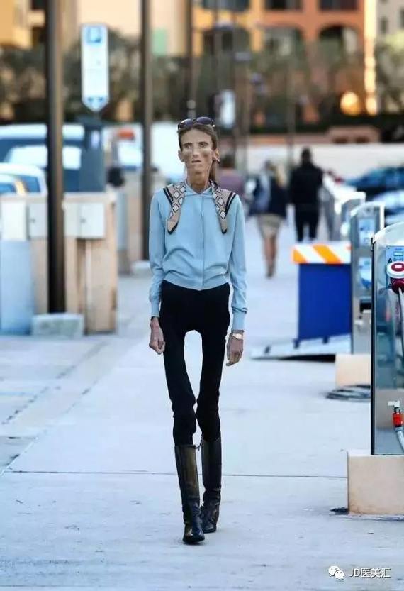 说丽兹的图与文章并没有让人感到厌恶,也表示不想像她一样瘦