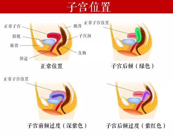 子宫后位宫颈上翘图片图片