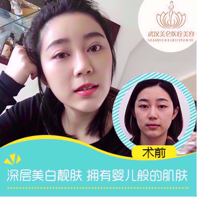 【白瓷娃娃】(白瓷娃娃)嫩肤净肤 均匀肤色 瓷肌美肤 首次体验