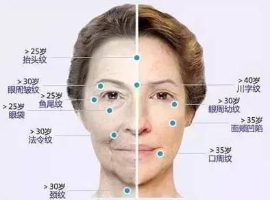 第1条皱纹最早出现的年龄是18-19岁,不表情,有皱纹.