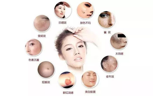 新陈代谢开始出卖你,浅斑开始形成;40岁,肌肤老化,生育影响,各类色斑