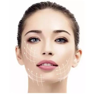 【埋线提升】全脸童颜面雕