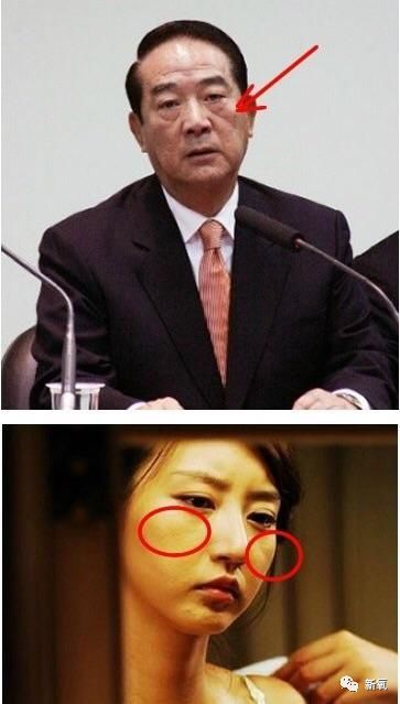 所以也有人叫它"破颧纹".