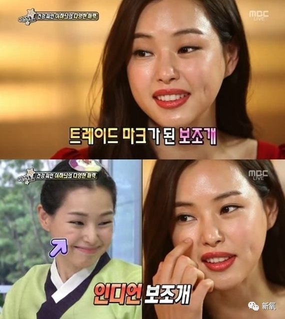 复习完鼻唇沟,羊要说今天的重点了,今天羊想跟大家细说脸上的另一个