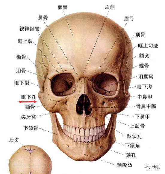 是这个红色的部分,上颌一直到眶骨位置的骨体发育不足