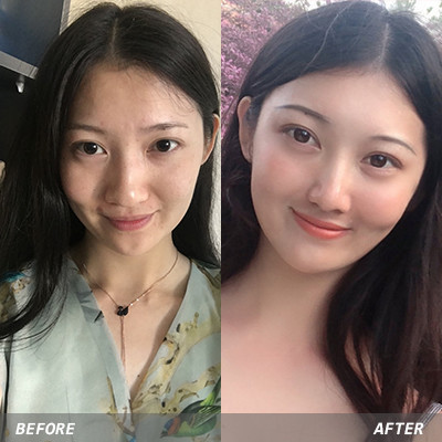 【其他填充剂】ruffy韩国婴儿针2ml 含6种促进细胞活性因子 保湿 抗衰