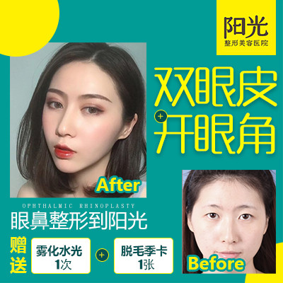 眼角】精细化操作 就选阳光老字号【私信红包】网红明眸大眼 睫毛上翘