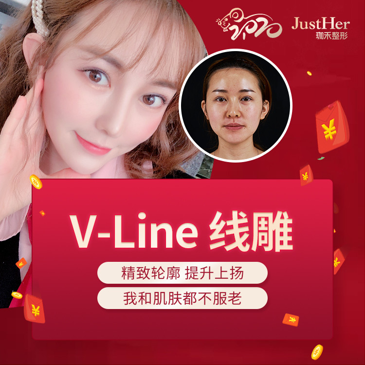 【埋线提升】韩国美迪塑线雕 超高性价比 单部位 法令纹/提眉/苹果肌