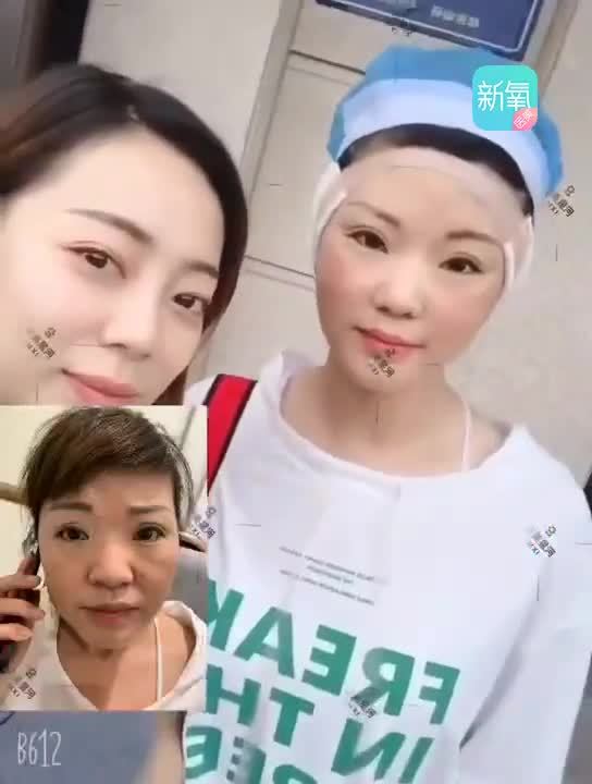 首页 商品 机构 医生 社区 医美百科 整形有风险决策需谨慎 登录 姐姐