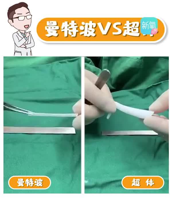 假体展示曼特波vs超体的对比