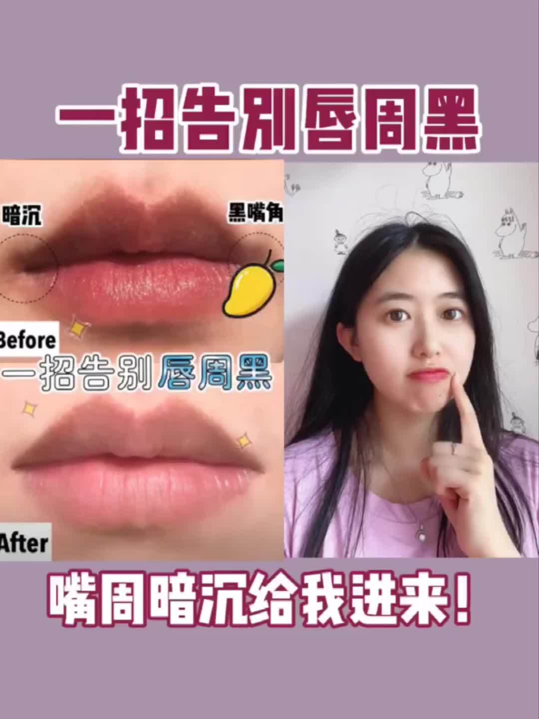 亲测唇周黑改善方法一周告别唇周黑