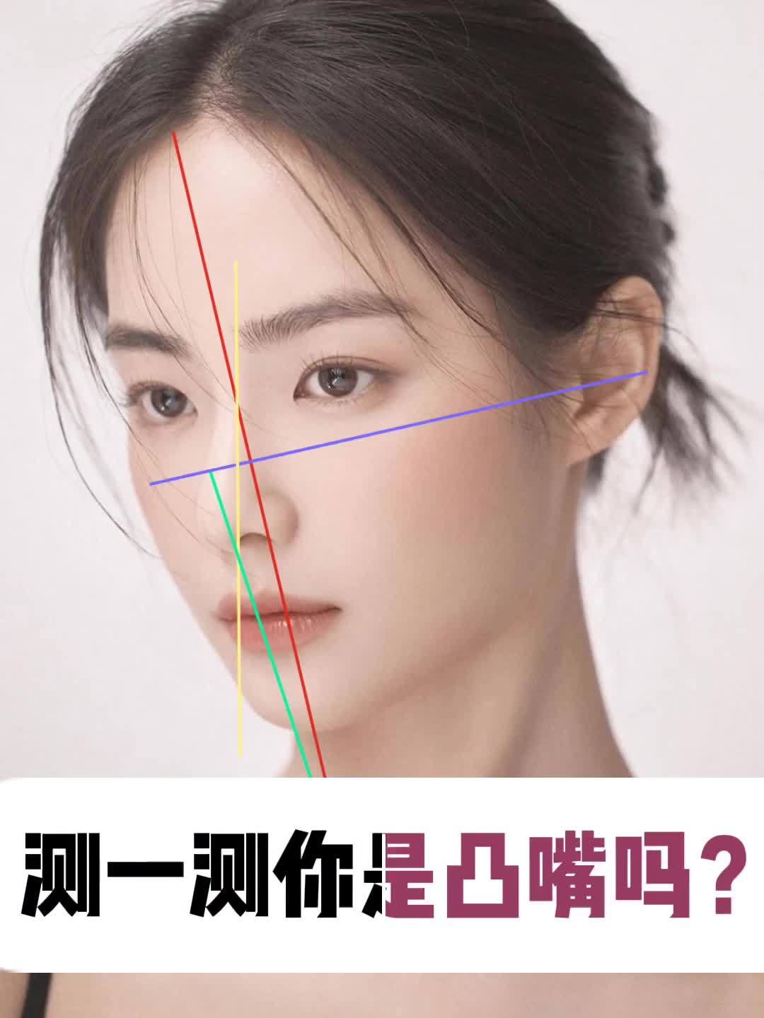 30秒自测你是不是凸嘴