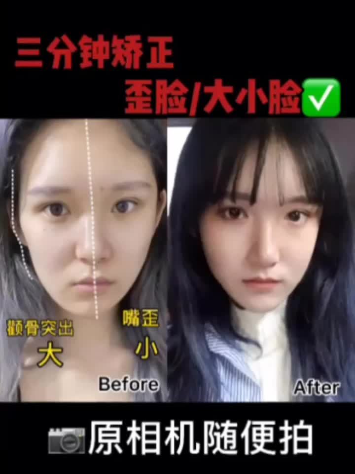 教你矫正大小脸 歪脸!_圈子-新氧美容整形