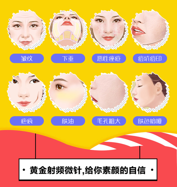 【射频紧肤】以色列bodytite黄金射频微针 提升紧致抗衰老 改善面部