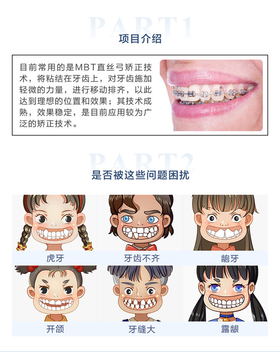 金属托槽矫正牙齿矫正国产金属自锁矫正半隐形矫正