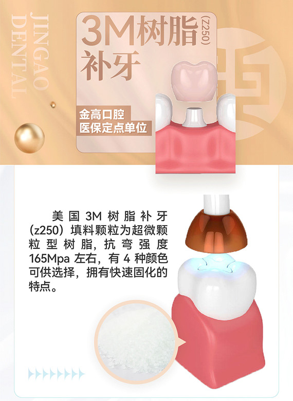 补牙美国进口3m树脂补牙z250补牙龋齿蛀牙坏牙修复