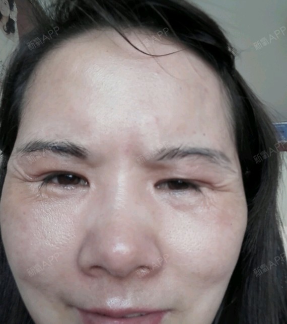 整容失败美丽日记