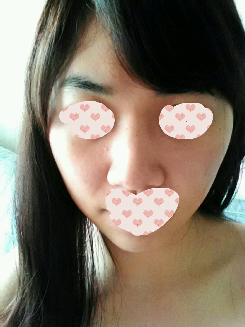 这几天下雨颧骨一边又开始痛了,去拍片医生也没发现什么,那我这是什么