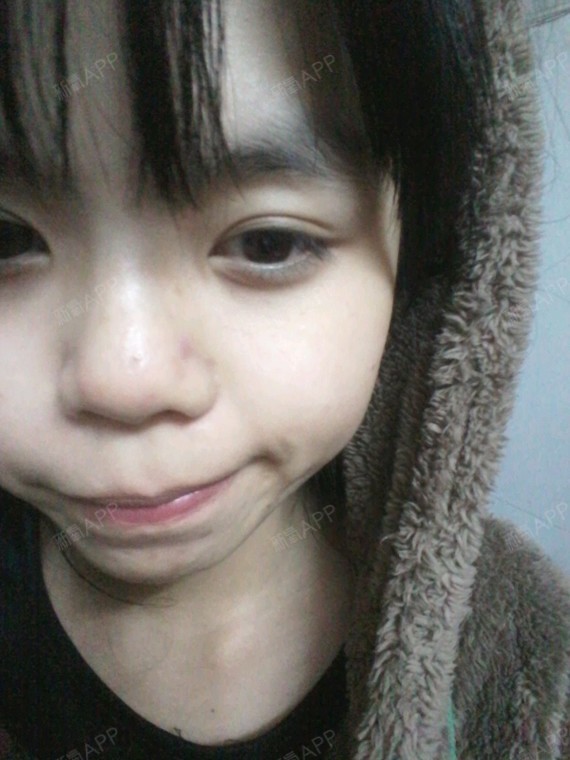 2015年12月 0 氧气姐 几个月了? 2015年12月 0 良辰美景反光镜换 